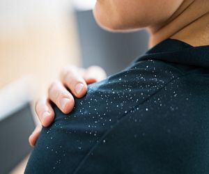 Hand brushing away dandruff from shoulder